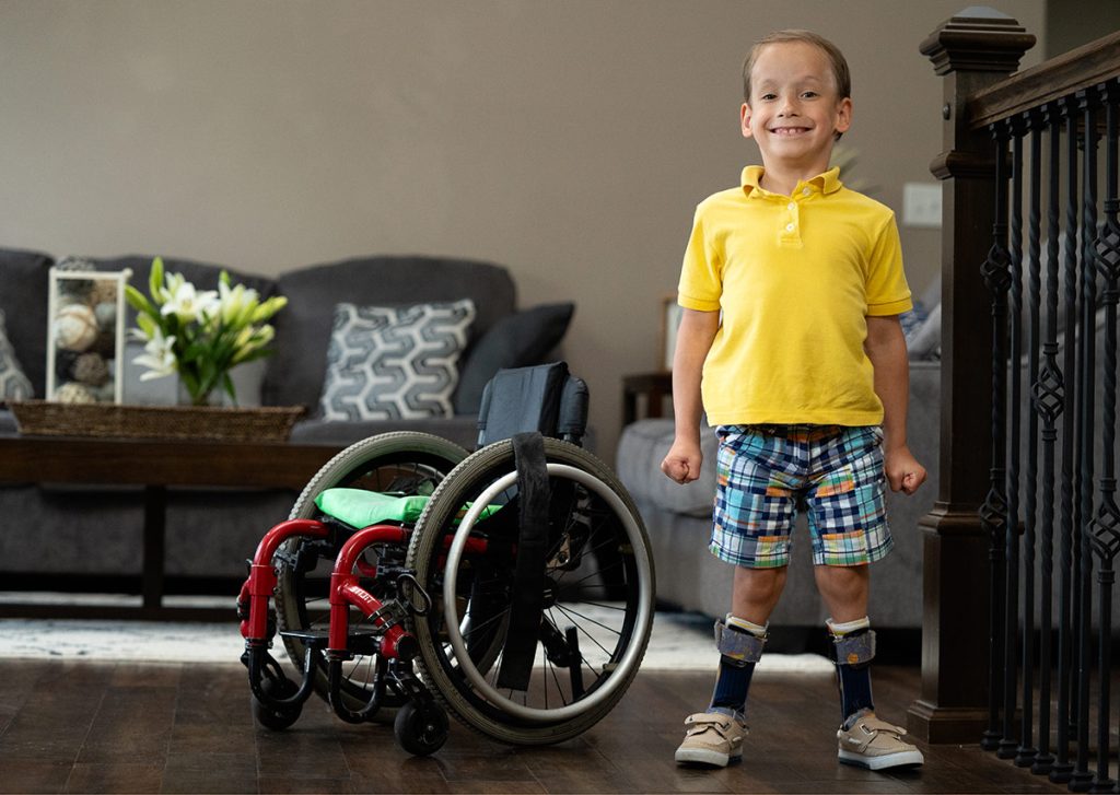 spina bifida dan masalah ortopedi pada anak