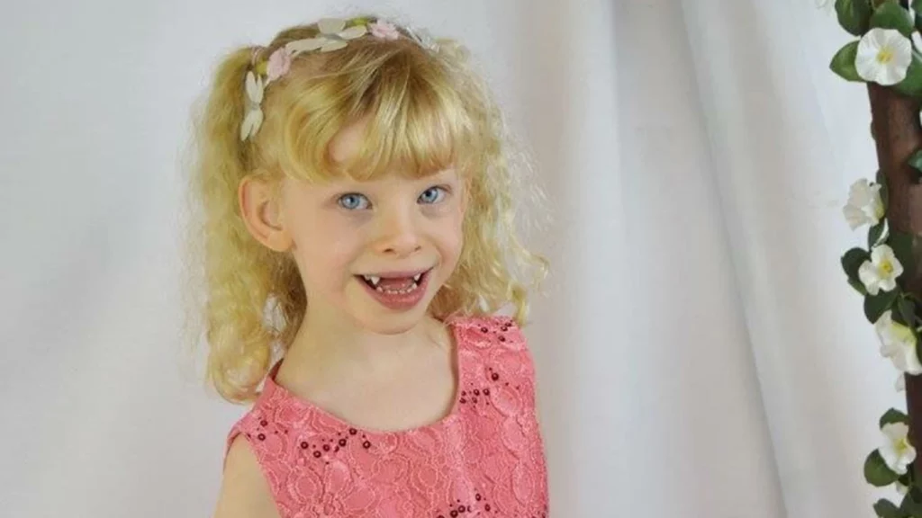 cara mengajarkan anak Williams Syndrome tentang waktu