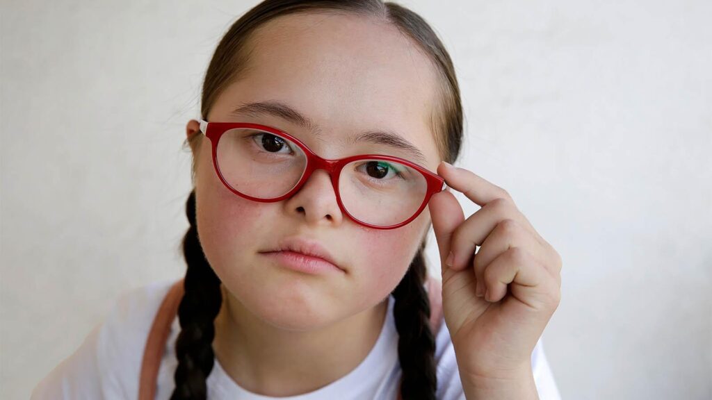 down syndrome dan masalah mata