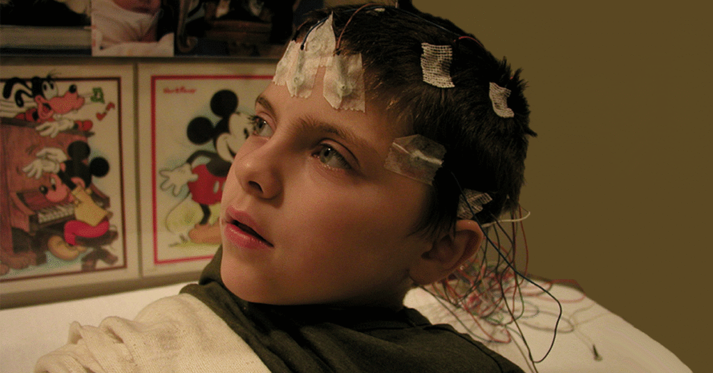 fragile x syndrome dan masalah ginjal