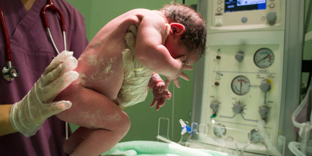 Cara membersihkan kateter anak spina bifida