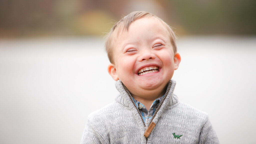 down syndrome dan disabilitas intelektual