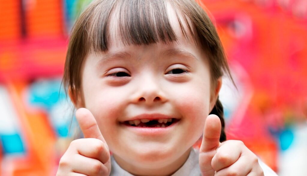 Cara Melatih Motorik Kasar Anak Down Syndrome