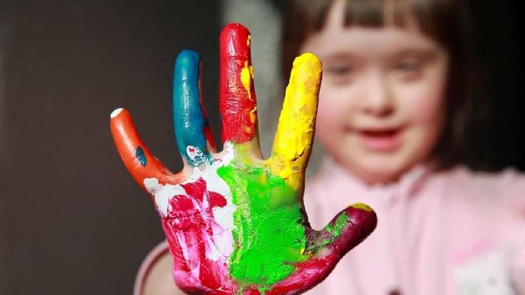 Down Syndrome dan Masalah Jantung