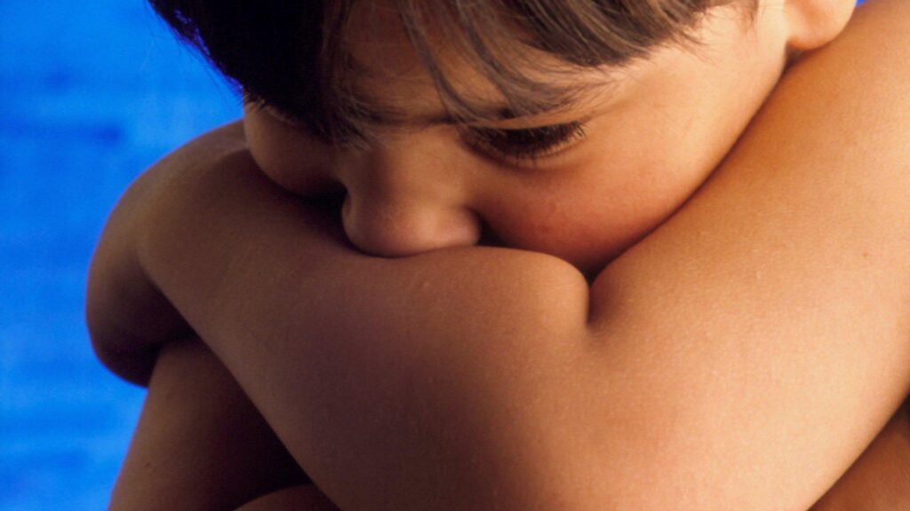 Williams Syndrome dan Dukungan Psikologis