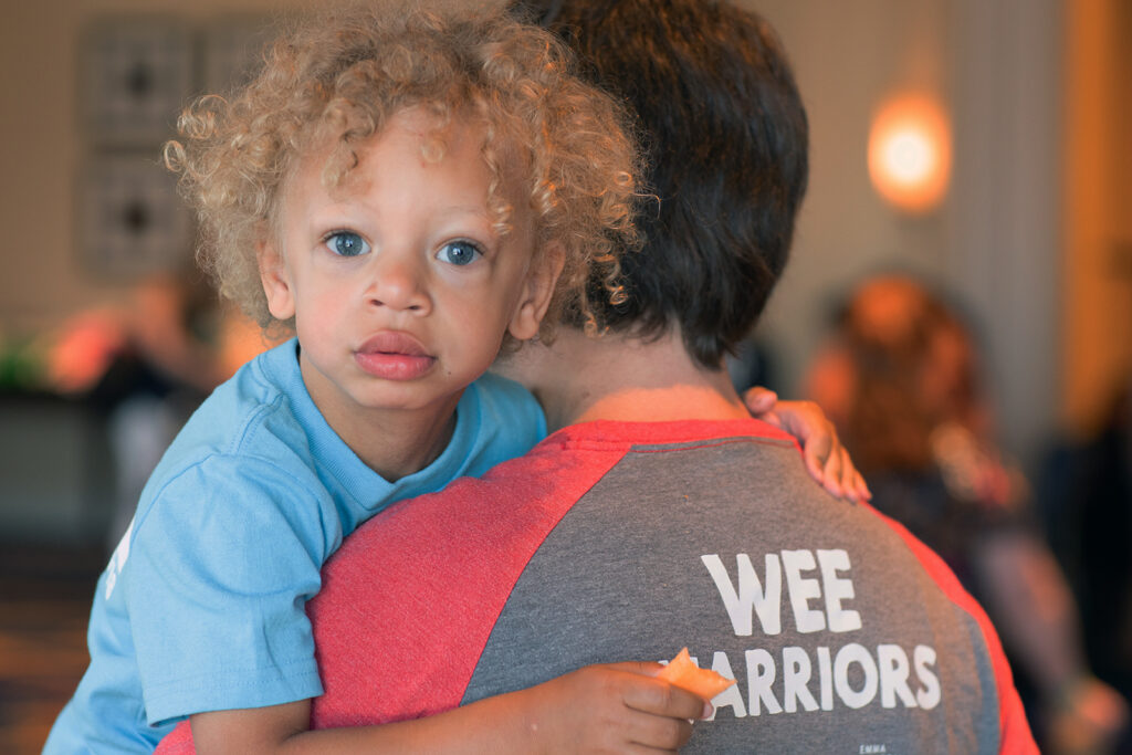 Williams Syndrome dan Terapi Fisik