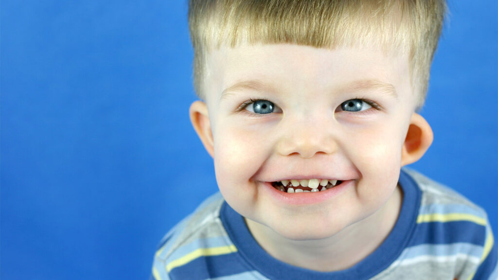Williams Syndrome dan terapi okupasi