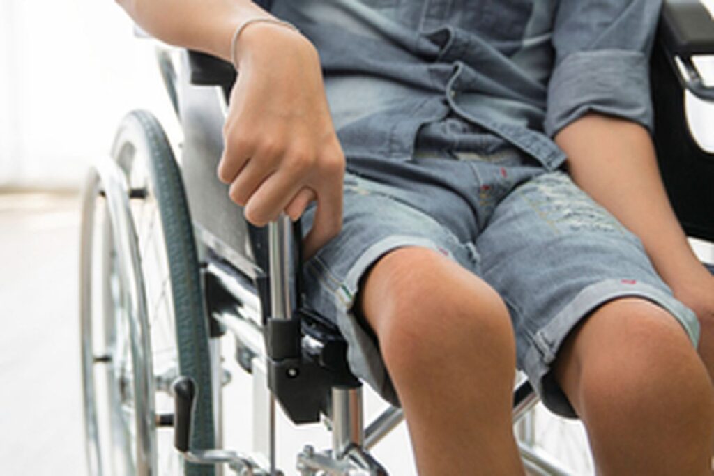 cara polio nular ke anak