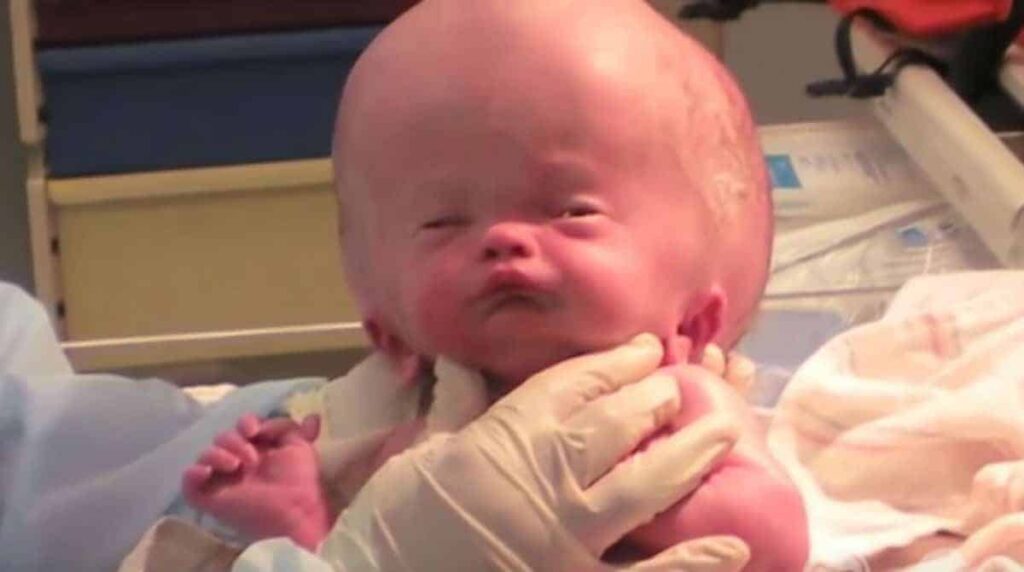 Tempat Pengobatan Hidrocephalus di Depok Terbaik