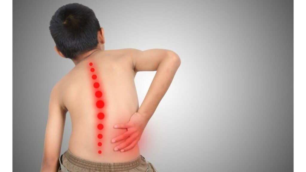 Tempat Pengobatan Skoliosis di Karawang Terbaik