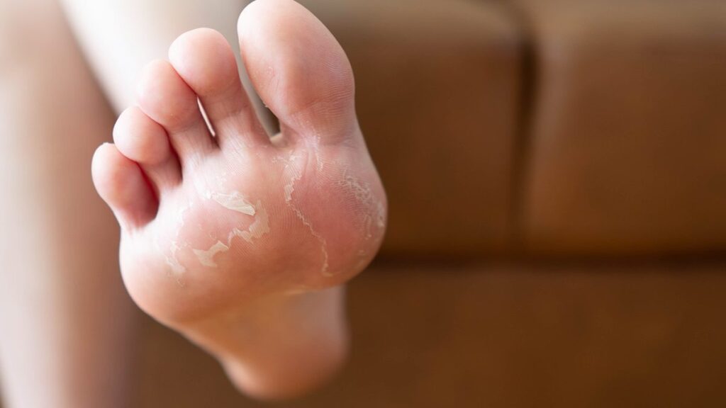 Tempat Pengobatan Diabetes di Depok Terbaik