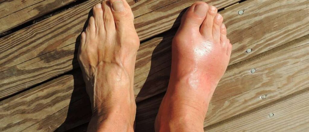 Tempat Pengobatan Diabetes di Karawang Terbaik