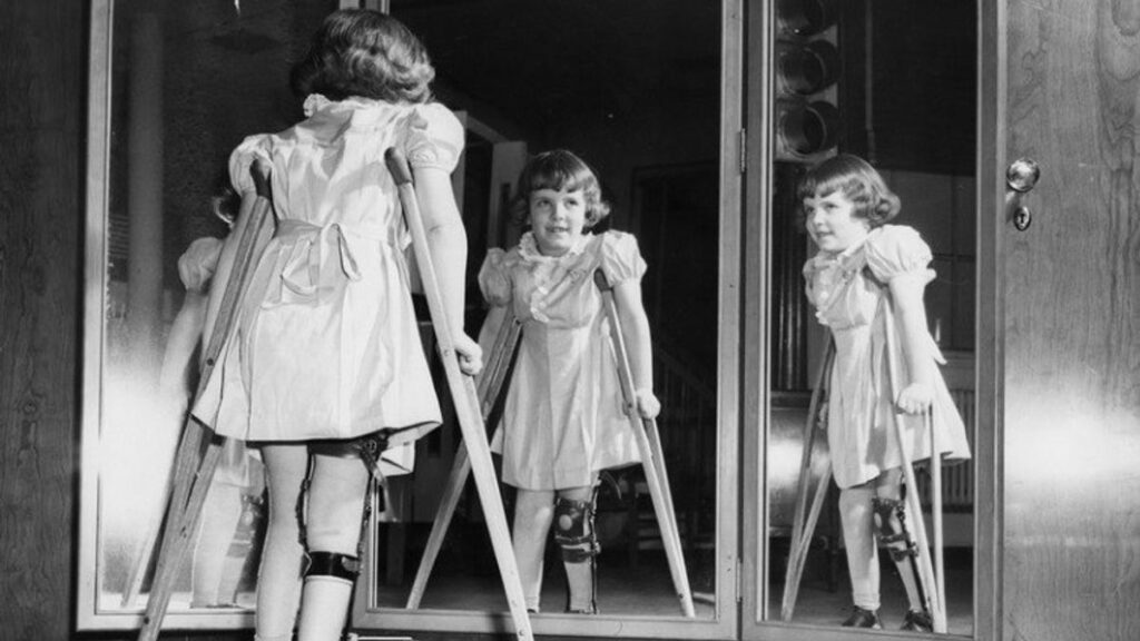 Tempat Pengobatan Polio di Karawang Terbaik