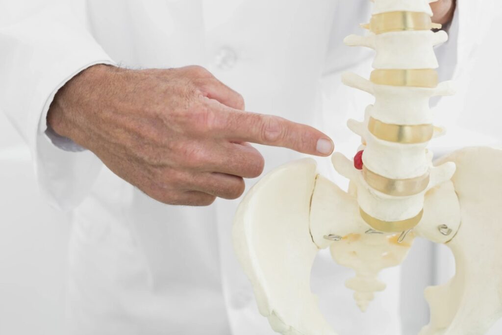 Atasi Radang Persendian, dengan 8 Cara Ini Biar Anda Sembuh