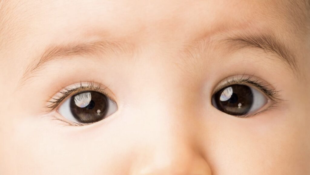 Bisakah Mata Juling pada Anak Sembuh Cuma dengan Terapi