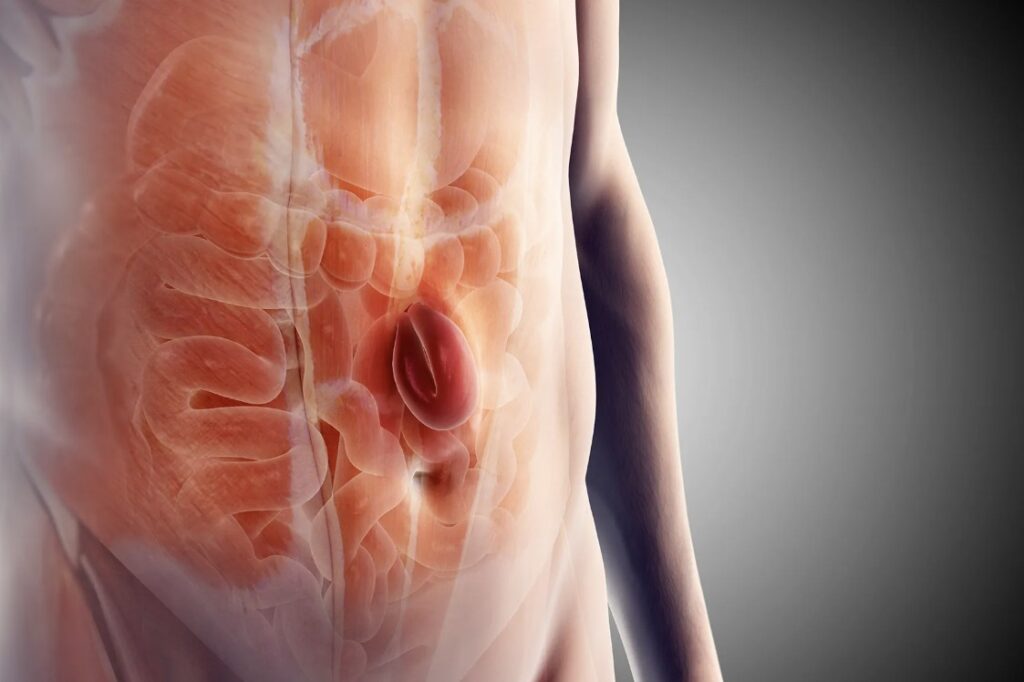 Ini 3 Fakta Hernia di Pusar yang Sering Dialami Orang Dewasa