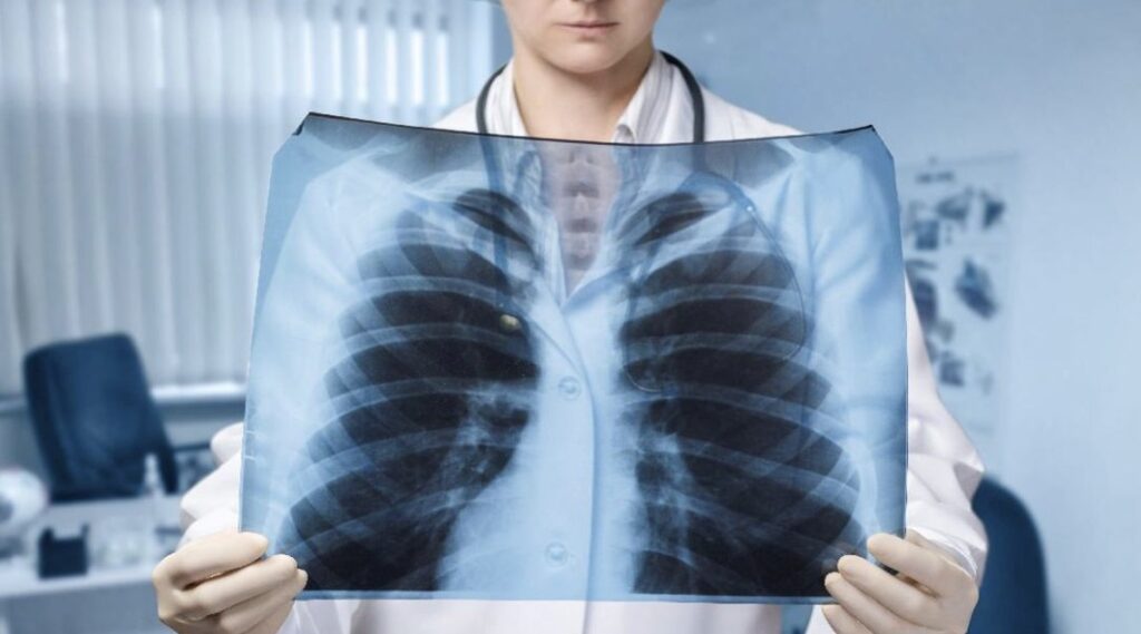 Paru-Paru Lemah Karena Merokok 3 Solusi untuk Atasi Hal ini