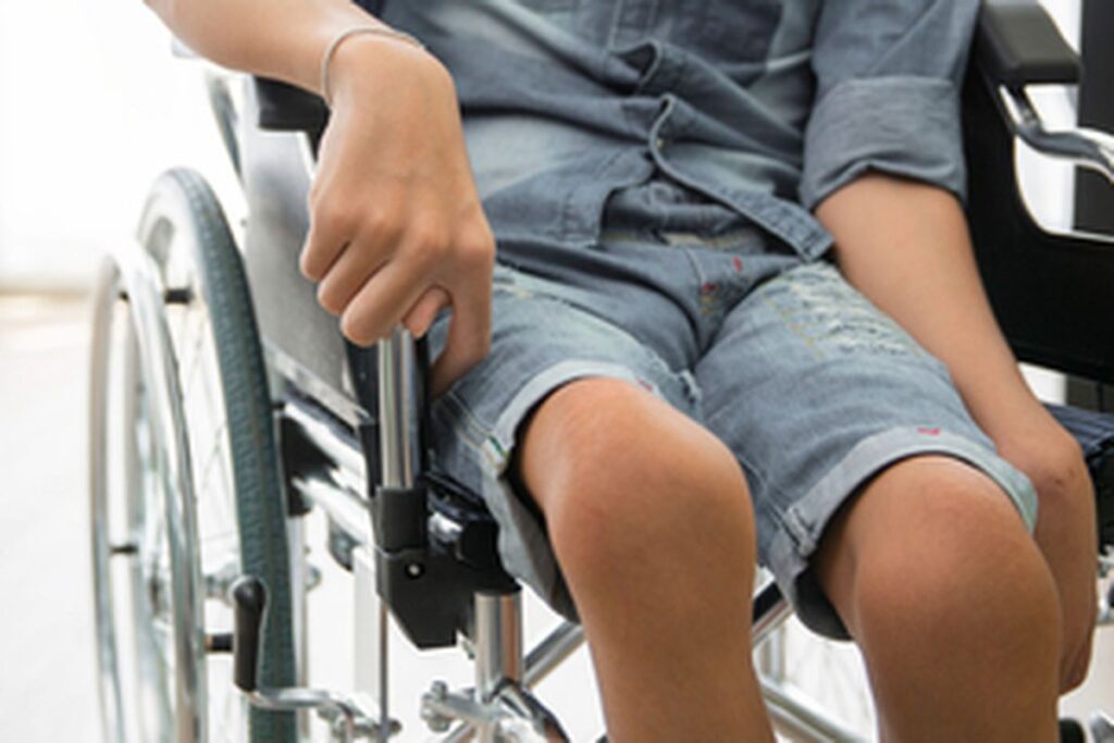 Polio dan Kelainan Tulang Belakang Anak