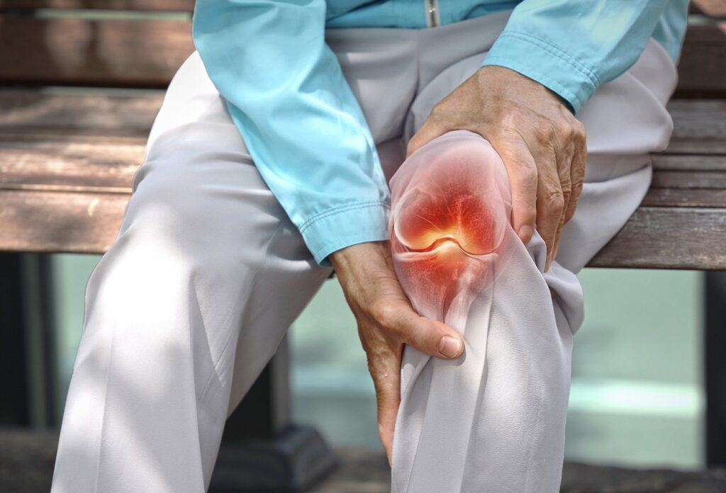 5 Gejala Aneh Radang Sendi yang Sering Abaikan