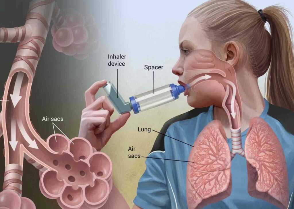 Benarkah Mandi Air Dingin Bisa Asma, Mitos atau Fakta