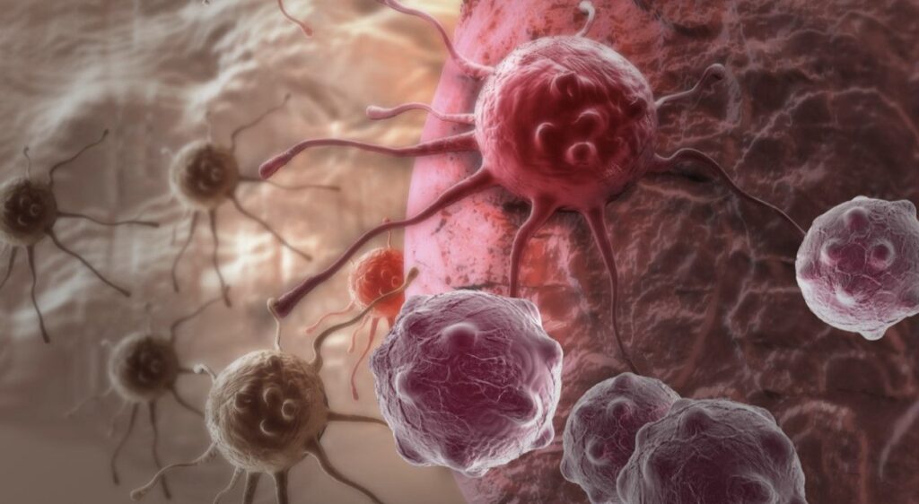 Kanker Bikin Gak Nafsu Makan Ini 9 Ide yang Bisa Konsumsi