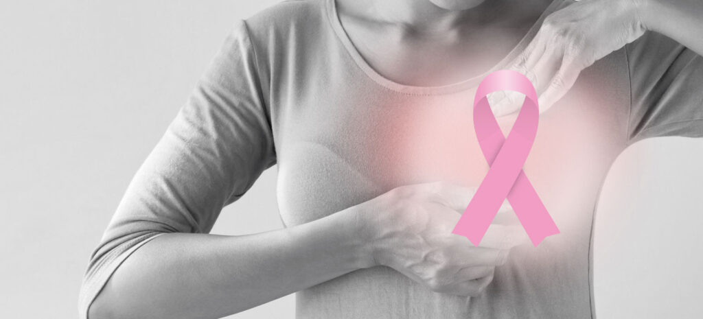 Kanker Payudara