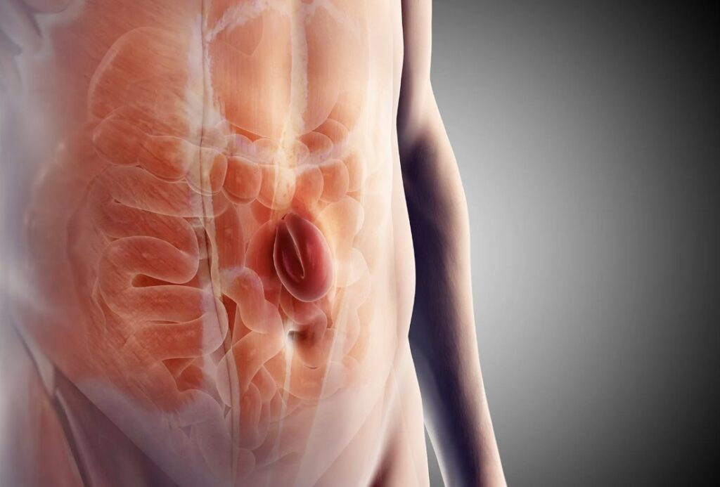 Anda Harus Tahu, 4 Jenis Hernia Sembunyi Susah Dideteksi