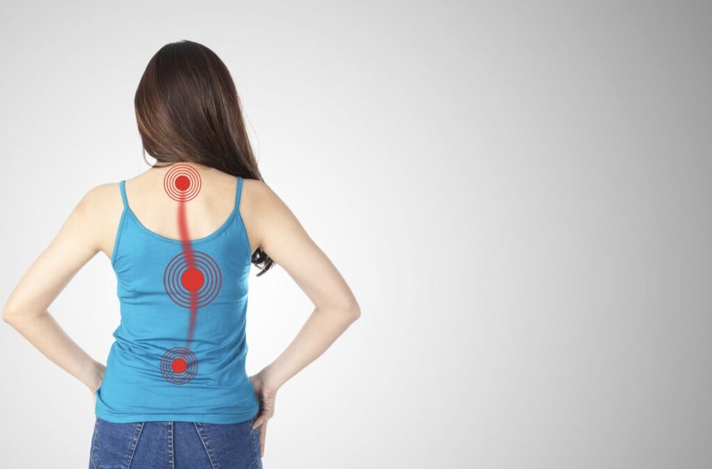 Ini 3 Hubungan Antara Skoliosis dan Seringnya Kaki Kesemutan