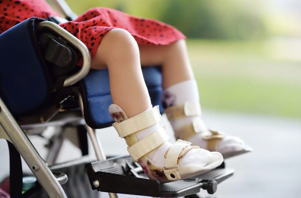 Apakah Benar Air Putih Obat agar Anak Tidak Cerebral Palsy