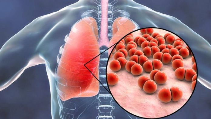 Tempat Pengobatan Pneumonia di Tangerang yang Terbaik