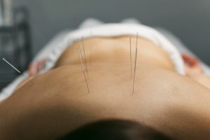 Wanita Kuat Pejuang Skoliosis Kini Sembuh Tanpa Operasi
