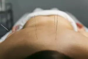Wanita Kuat Pejuang Skoliosis Kini Sembuh Tanpa Operasi