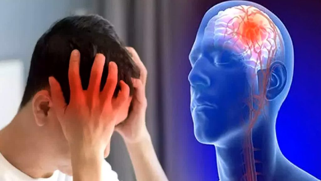 tempat terapi stroke hemoragik atau stroke iskemik berat di Bekasi