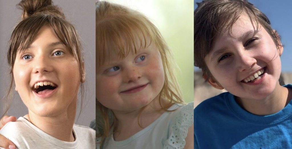 2 Cara Menemukan Terapi Atasi Rett Syndrome pada Anak