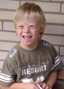 Belajar Kosakata Baru pada Anak Down Syndrome + Tunarungu