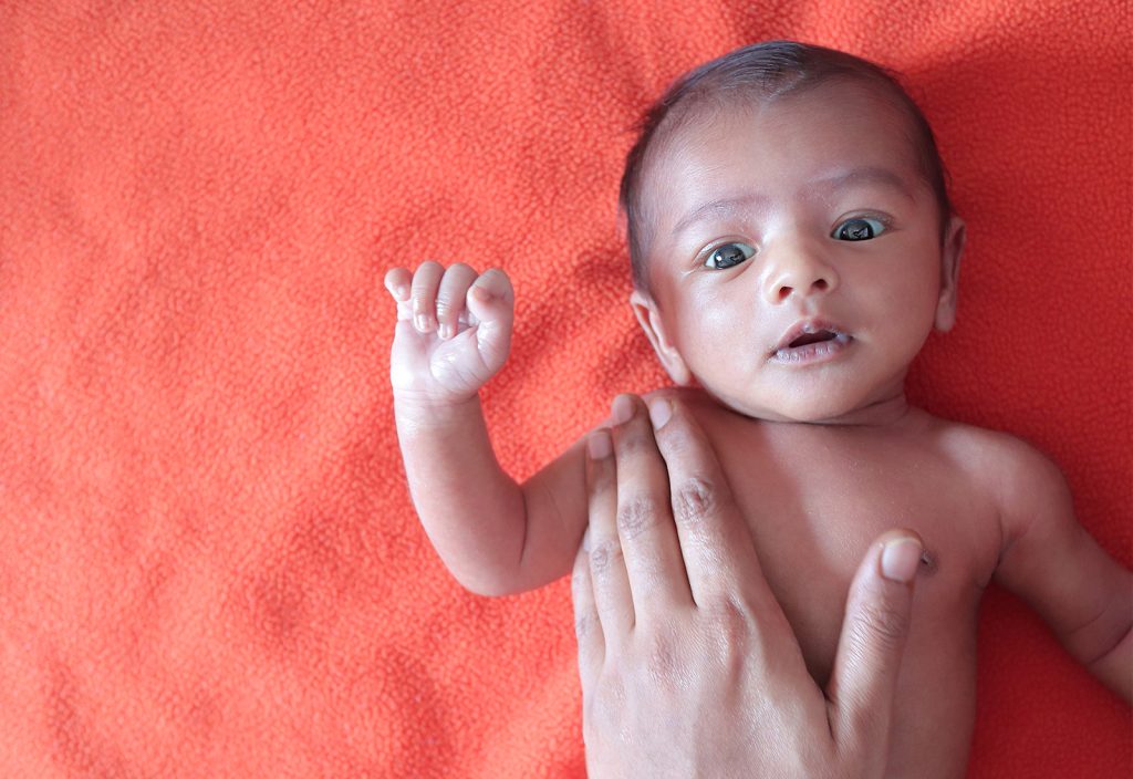 gejala cerebal palsy pada bayi baru lahir
